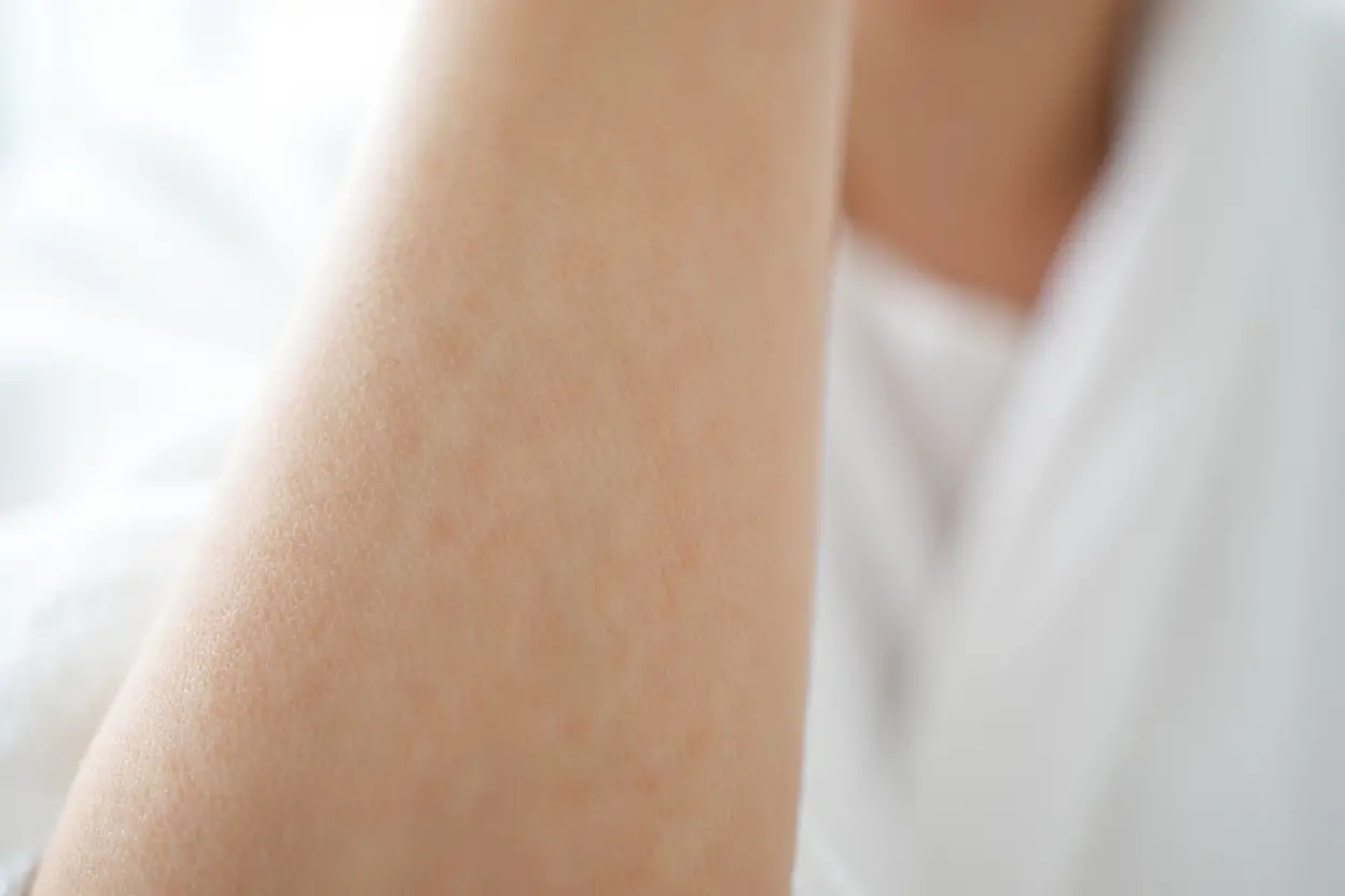 Peau saine et soignée