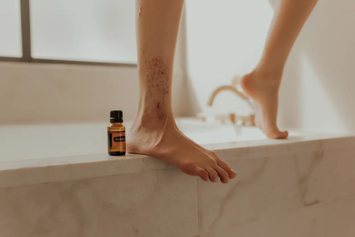 Flacon d'huile essentielle posé sur un comptoir de salle de bain près d'une jambe présentant des varices.