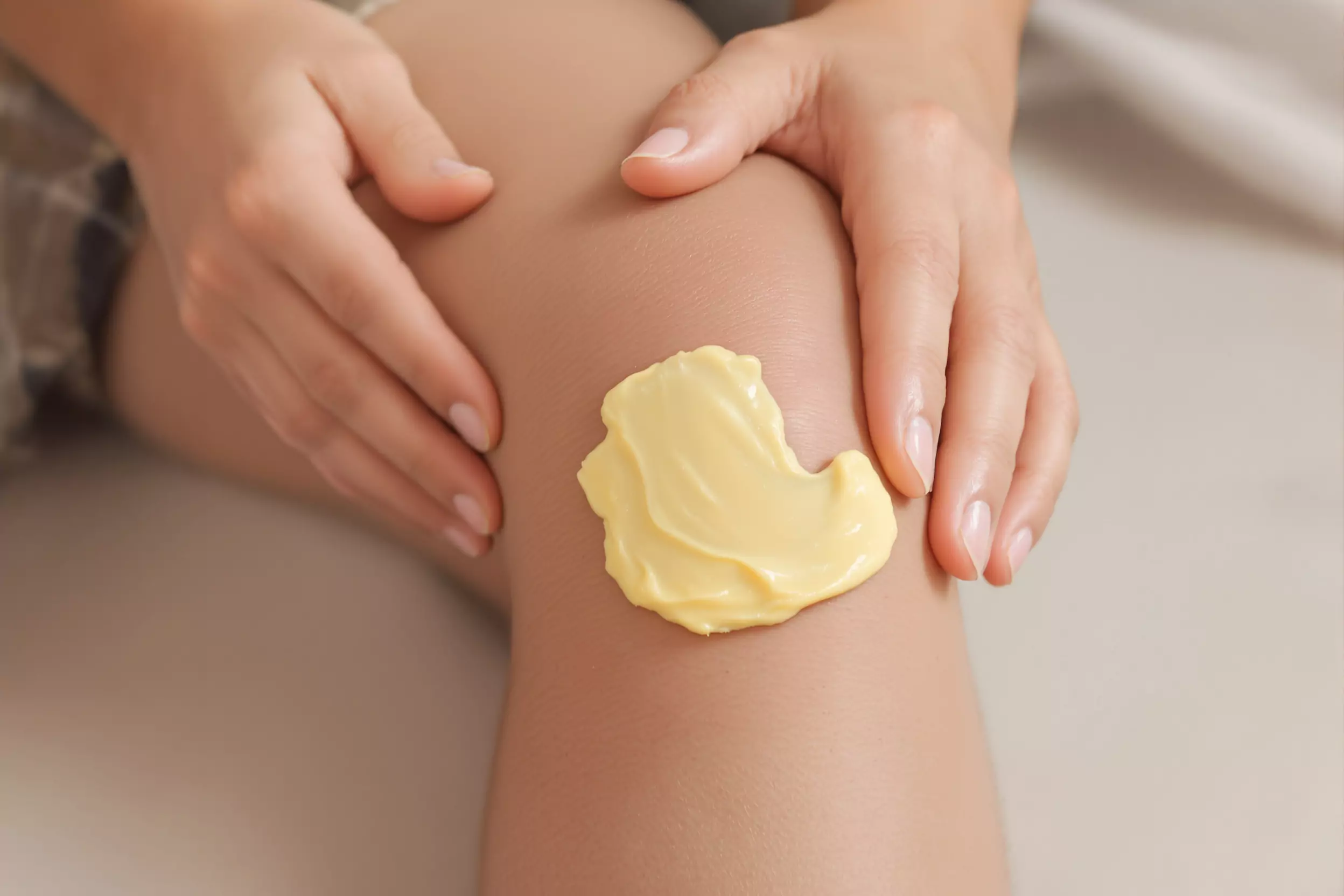 Application de crème jaune sur le genou, mains entourant la zone pour masser, contexte soin douleurs arthrose